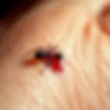 Close-up of Ant Bite Swelling Close-up of an ant bite on skin showing redness and swelling