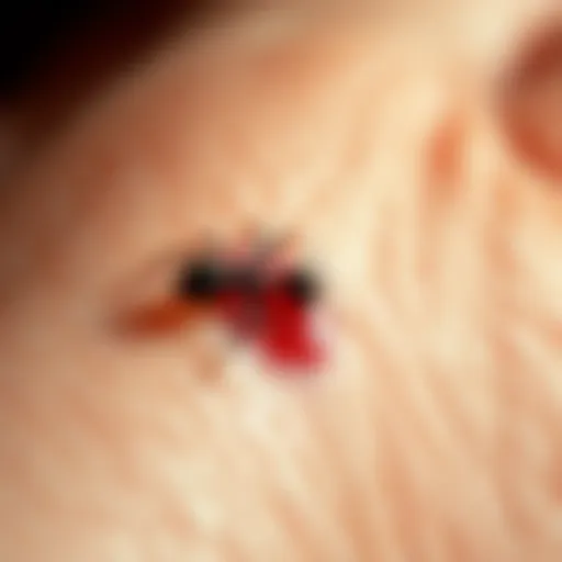 Close-up of Ant Bite Swelling Close-up of an ant bite on skin showing redness and swelling