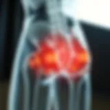 Diagram illustrating common musculoskeletal disorders causing buttock pain