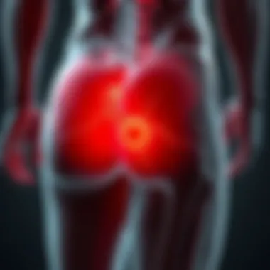 Infographic on nerve injuries leading to buttock pain