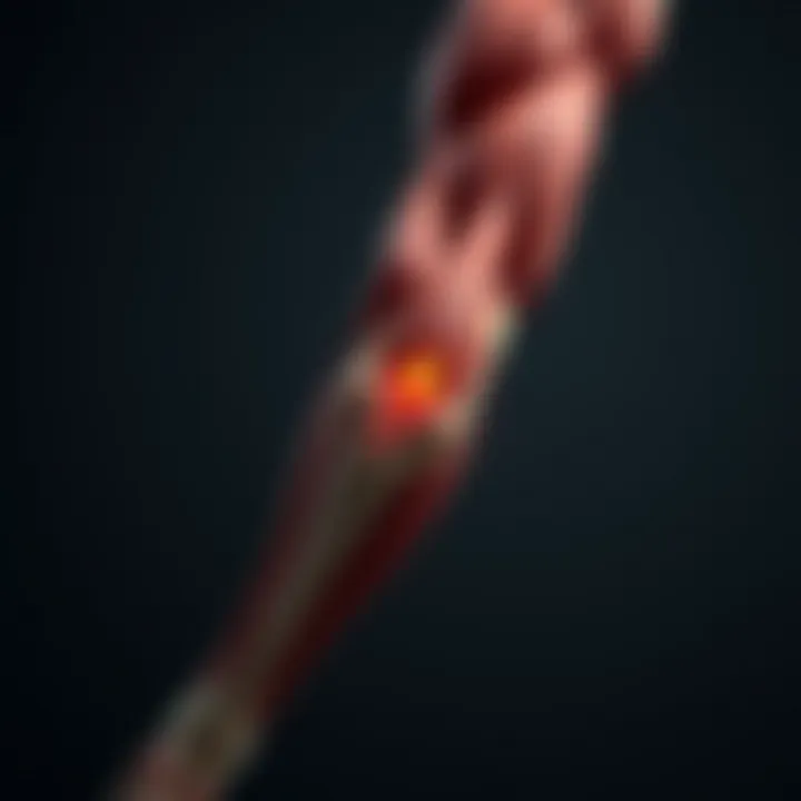 Illustration of muscle anatomy highlighting areas prone to tears