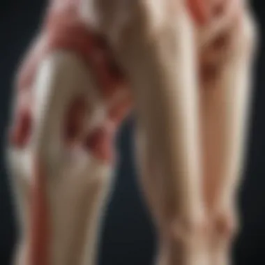 Comparison of Healthy and Arthritic Joints Anatomical illustration of a healthy joint compared to an arthritic joint