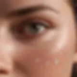 Illustration of Evra patch application on skin surface