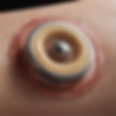 Visual representation of the skin patch mechanism