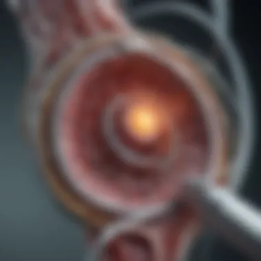 Understanding Coronary Stent Systems Illustration of a coronary stent system