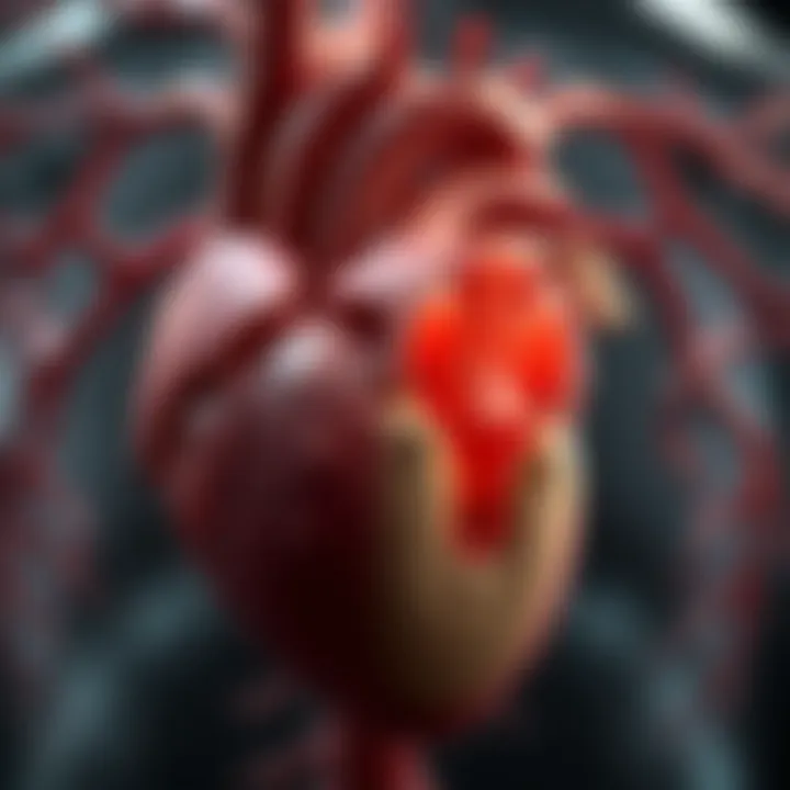 Anatomy of Mitral Valve Prolapse Illustration of a heart with mitral valve prolapse