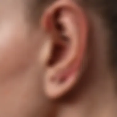 Skin Anatomy and Eczema Illustration of the skin anatomy around the ear affected by eczema.