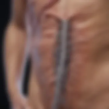 Graphic representation of the mechanisms linking colon cancer and night sweats