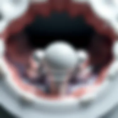 Overview of materials utilized in implant ball attachments