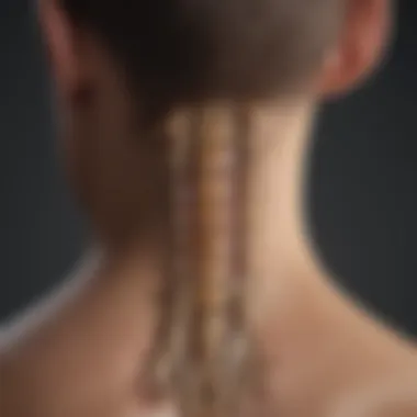 Recognizing Symptoms of Spinal Stenosis Diagram depicting common symptoms of spinal stenosis