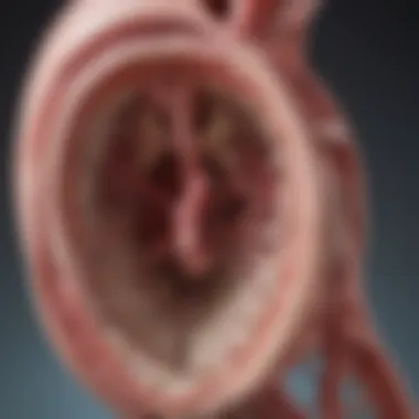 Bicuspid Aortic Valve Structure Diagram illustrating the structure of a bicuspid aortic valve and aneurysm