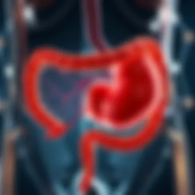 Bile Pathways After Gallbladder Removal Illustration of bile pathways post-cholecystectomy