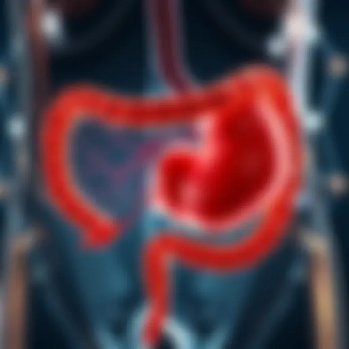 Bile Pathways After Gallbladder Removal Illustration of bile pathways post-cholecystectomy