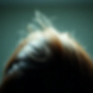 Genetic factors linked to hair loss in PCOS