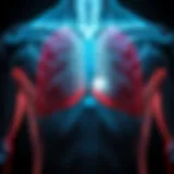 Illustration of pectus excavatum highlighting the sunken sternum