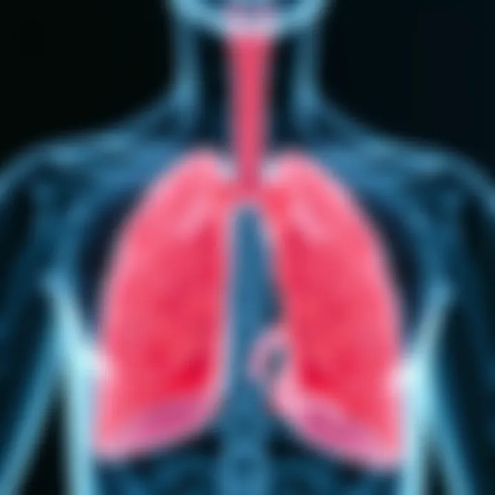 Respiratory System Impacted by Stage Four COPD A detailed diagram illustrating the respiratory system affected by severe COPD.