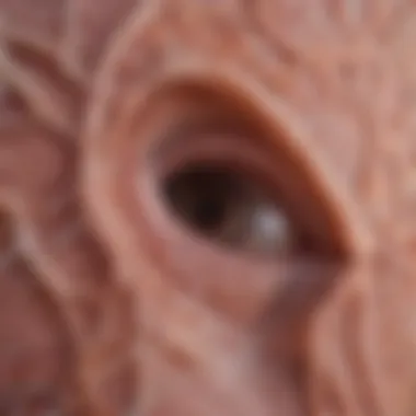 Connective Tissue in Marfan Syndrome Illustration of connective tissue structure affected by Marfan Syndrome