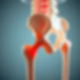 Detailed anatomical diagram of the hip joint with labels