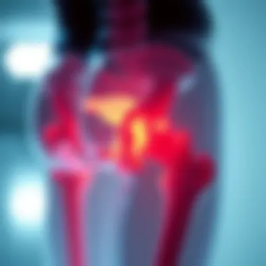 Visual representation of common conditions affecting the hip joint, including osteoarthritis